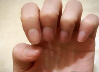 指甲冒白線=老了!遇5變化「該吃什麼」一圖看懂 有2異狀先就醫